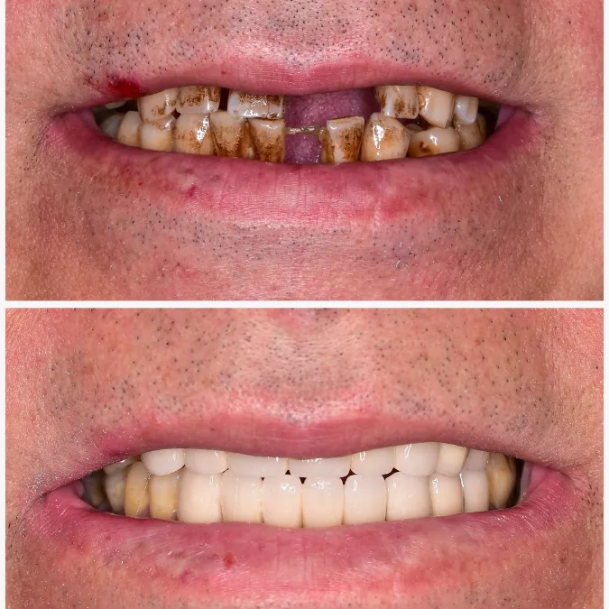 SMYLE patient transformation 4