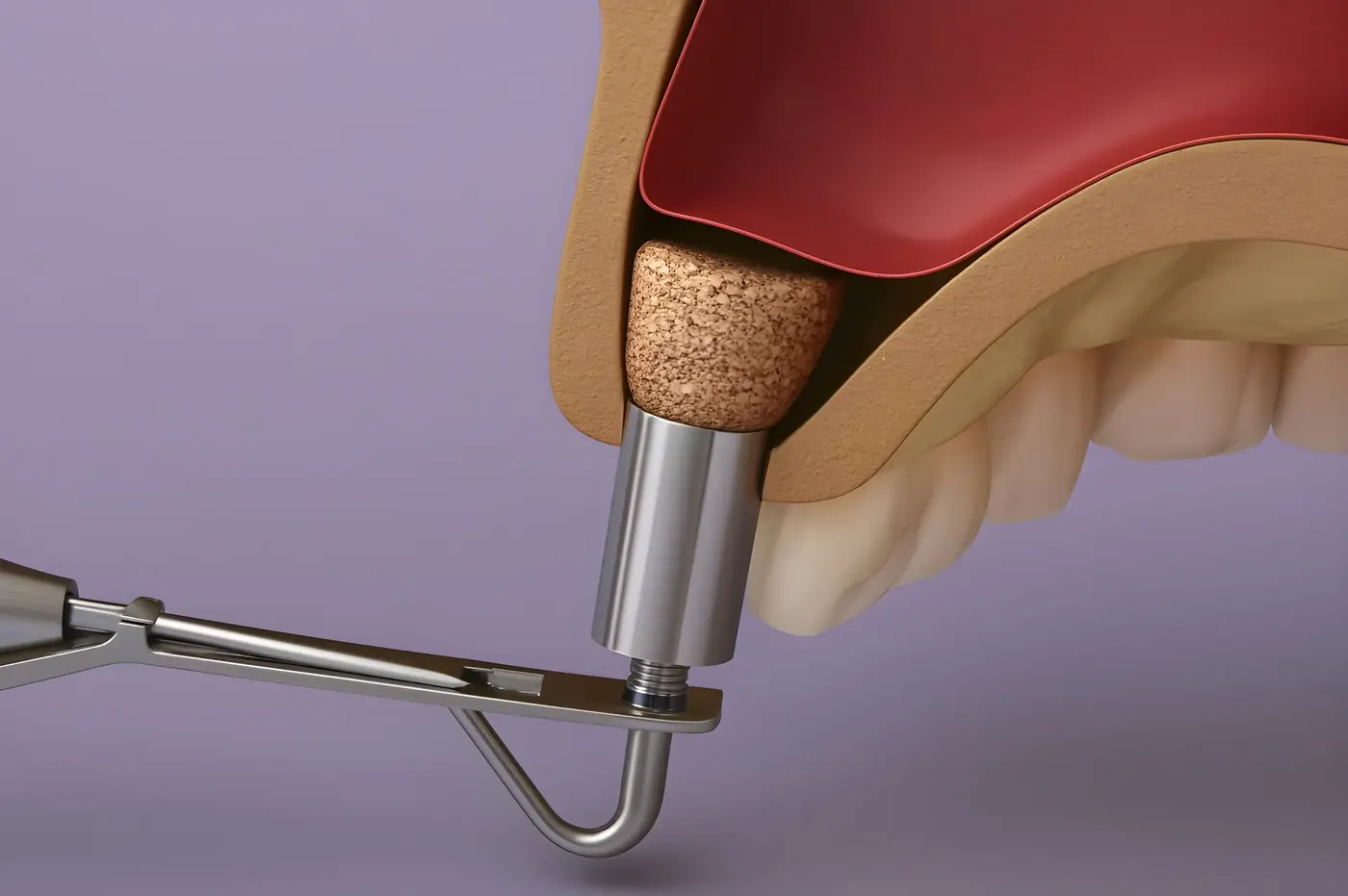 Sinus Lift